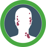 Sintomas Psoríase em placas